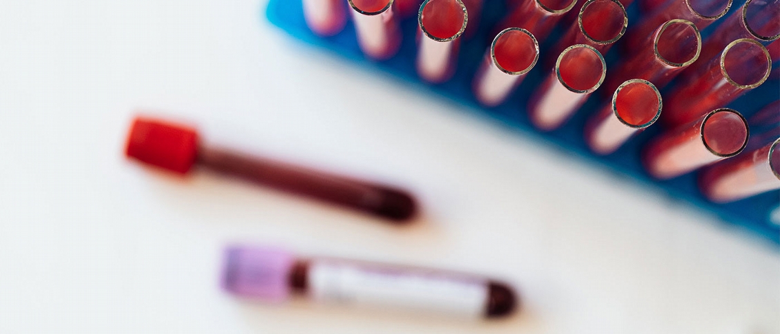 Ferritin och produktion av röda blodkroppar - blueiron_ferritiini_ja_rautavalmiste_01